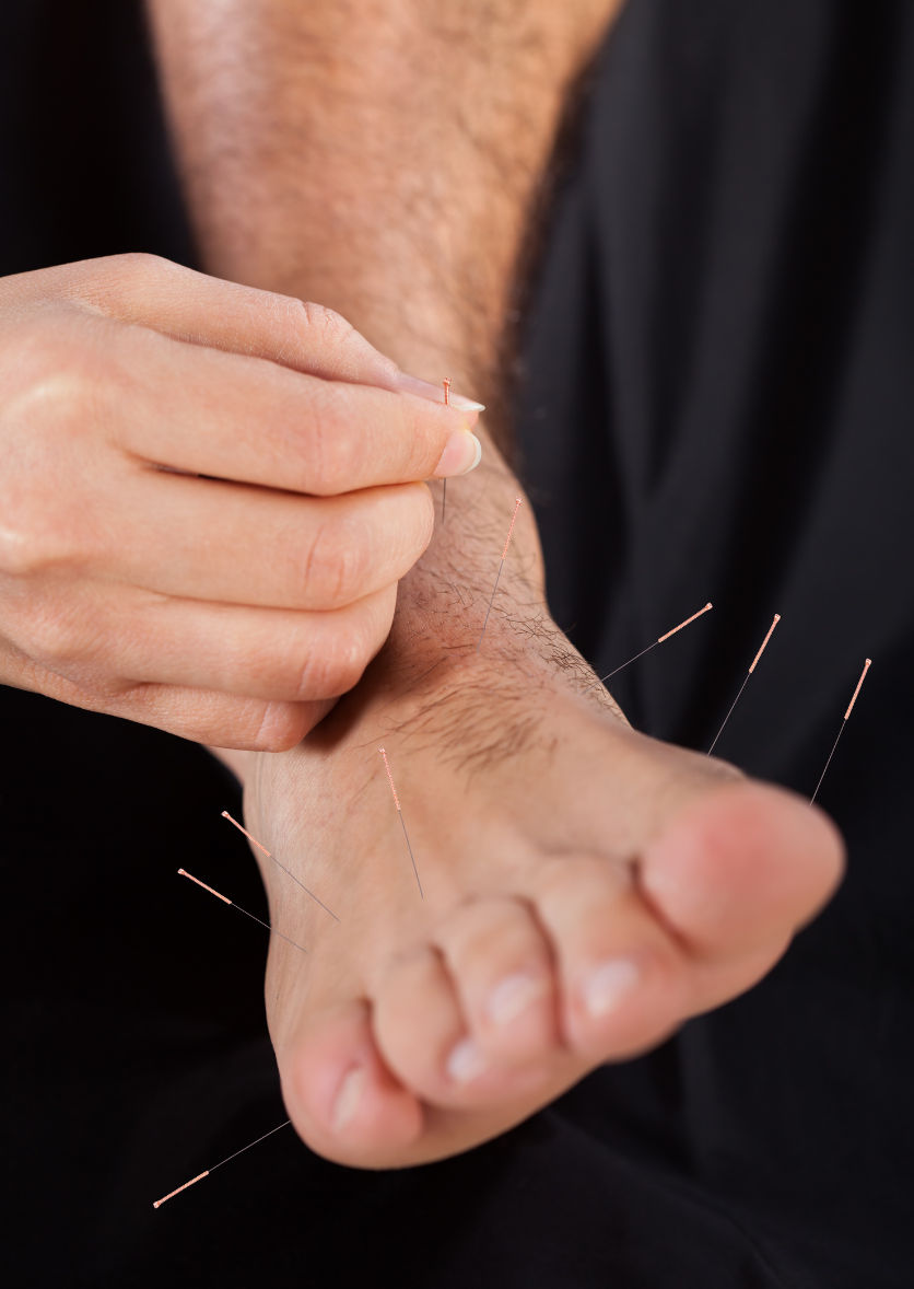 L'acupuncture pour votre santé